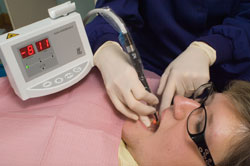 Hygienist using the DIAGNOdent laser detection system to find cavities in the patient's mouth
