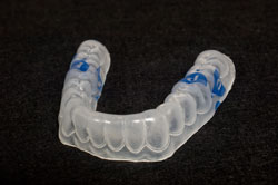 Perio Protect mouth tray