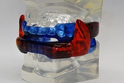 Patient wearing Dr. Maron's oral appliance for sleep apnea